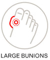 Bunions - Severe